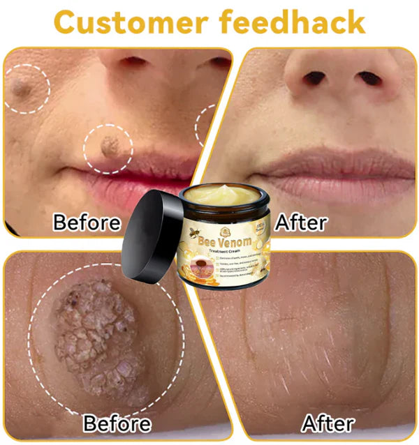 (Bee Venom) crema