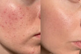 CREMA TRANEXAMICA DR.MELAXIN