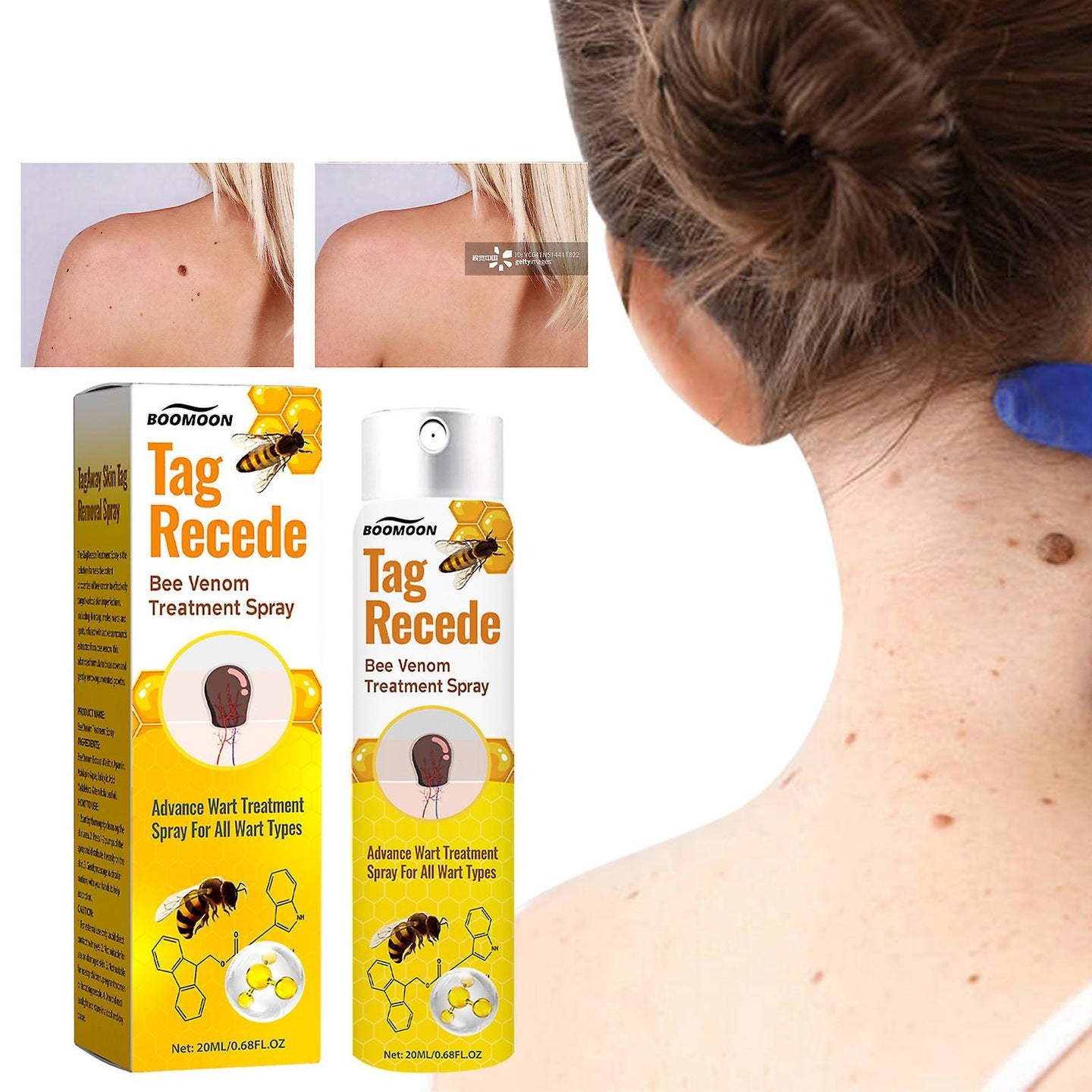 TAG RECEDE- REMOVEDOR DE IMPERFECCIONES